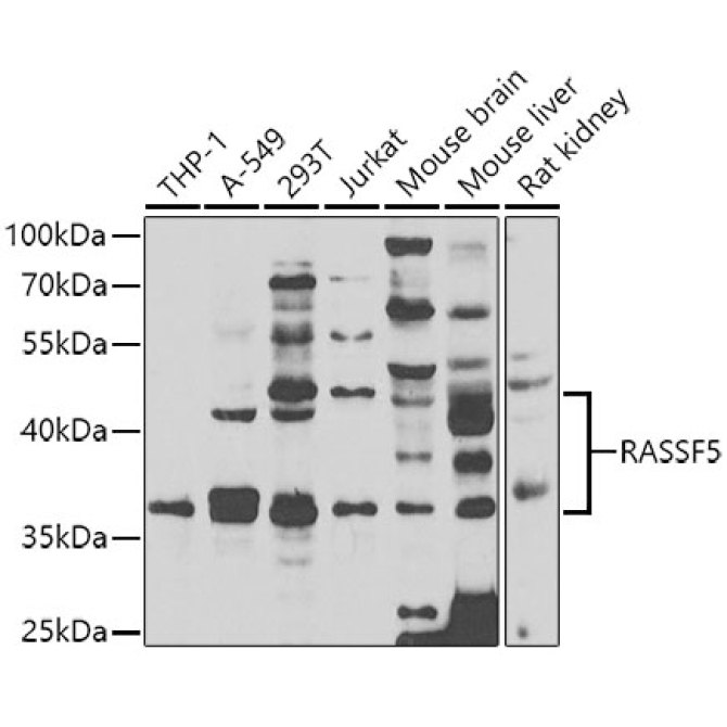 RASSF5 Rabbit Polyclonal Antibody