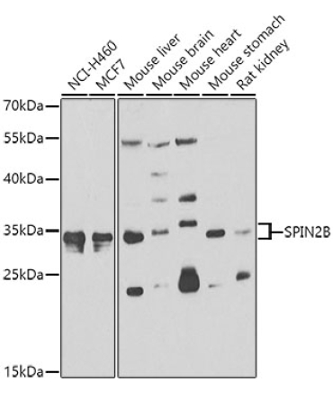 SPIN2B Rabbit Polyclonal Antibody