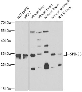 SPIN2B Rabbit Polyclonal Antibody