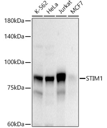 STIM1 Rabbit Polyclonal Antibody