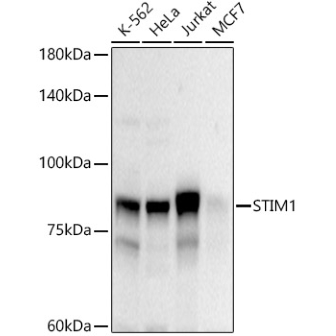 STIM1 Rabbit Polyclonal Antibody