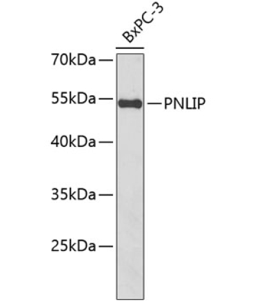 PNLIP Rabbit Polyclonal Antibody