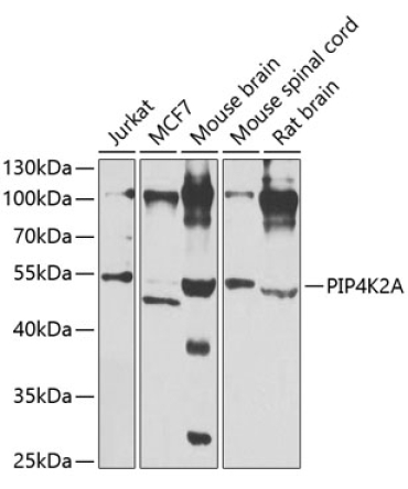 PIP4K2A Rabbit Polyclonal Antibody