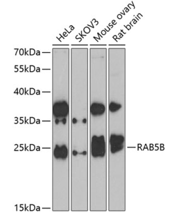 RAB5B Rabbit Polyclonal Antibody
