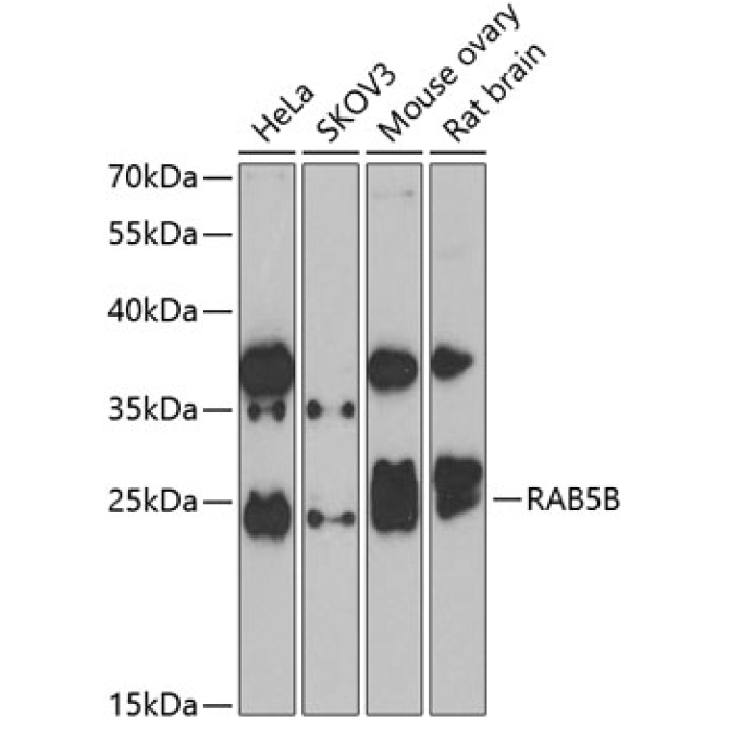 RAB5B Rabbit Polyclonal Antibody