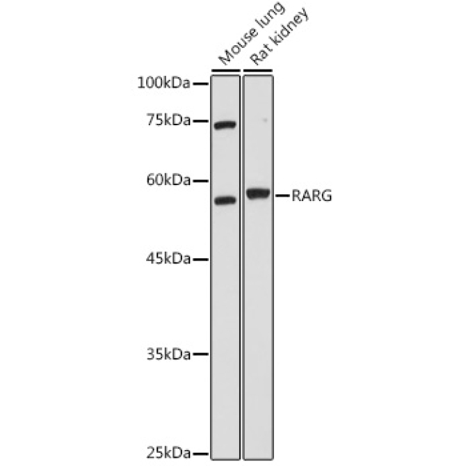 RARG Rabbit Polyclonal Antibody