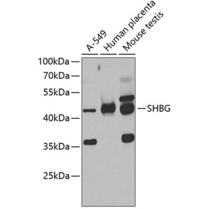 SHBG Rabbit Polyclonal Antibody