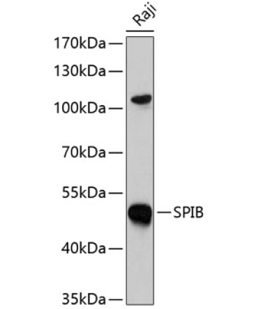 SPIB Rabbit Polyclonal Antibody