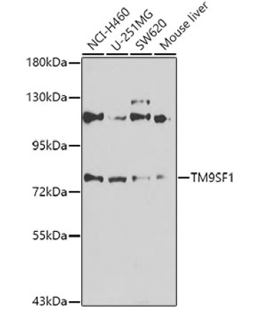 TM9SF1 Rabbit Polyclonal Antibody