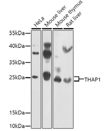 THAP1 Rabbit Polyclonal Antibody