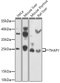 THAP1 Rabbit Polyclonal Antibody