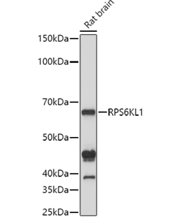 RPS6KL1 Rabbit Polyclonal Antibody