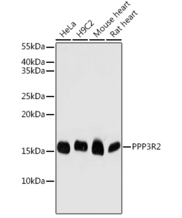 PPP3R2 Rabbit Polyclonal Antibody