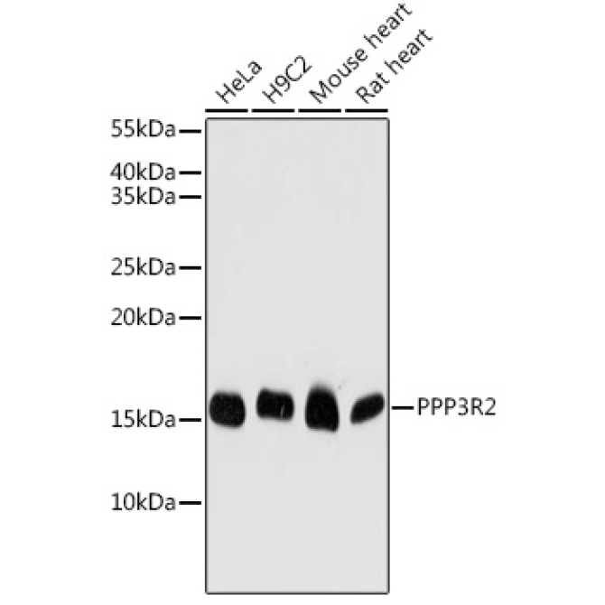 PPP3R2 Rabbit Polyclonal Antibody