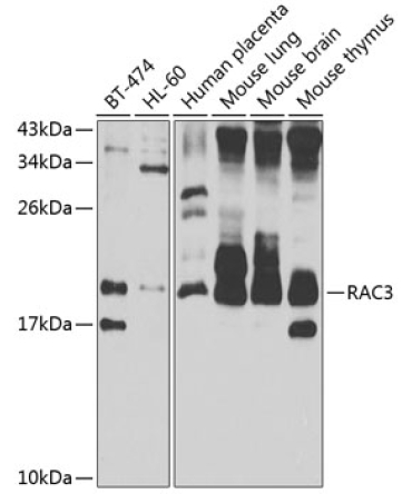 RAC3 Rabbit Polyclonal Antibody