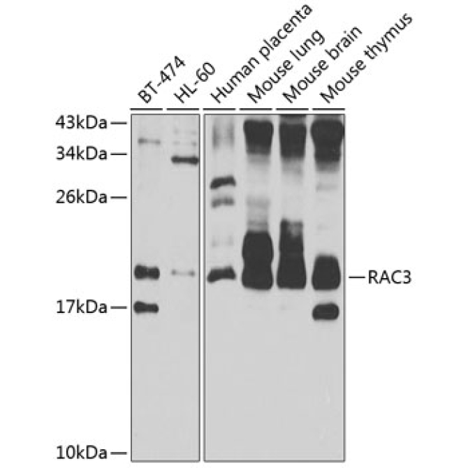 RAC3 Rabbit Polyclonal Antibody