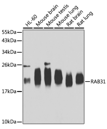RAB31 Rabbit Polyclonal Antibody