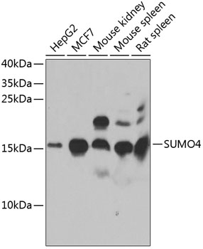 SUMO4 Rabbit Polyclonal Antibody