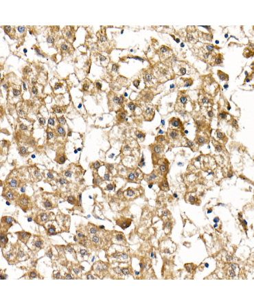 Smad9 Rabbit Polyclonal Antibody