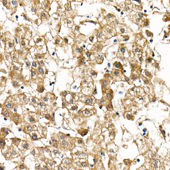 Smad9 Rabbit Polyclonal Antibody