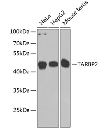 TARBP2 Rabbit Polyclonal Antibody
