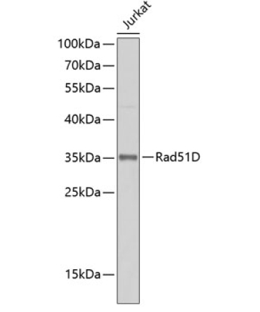 Rad51D Rabbit Polyclonal Antibody