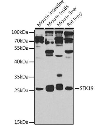 STK19 Rabbit Polyclonal Antibody