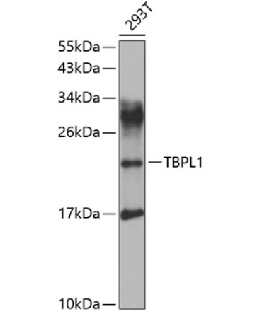 TBPL1 Rabbit Polyclonal Antibody