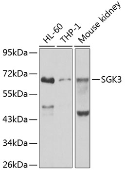 SGK3 Rabbit Polyclonal Antibody