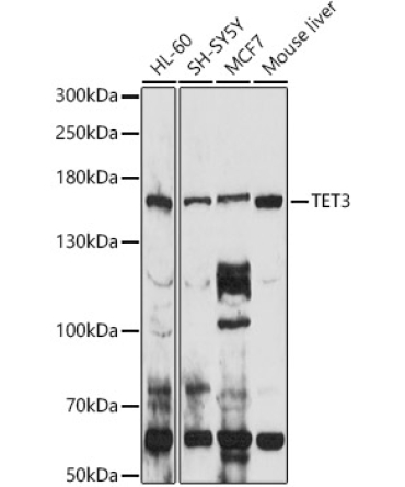TET3 Rabbit Polyclonal Antibody