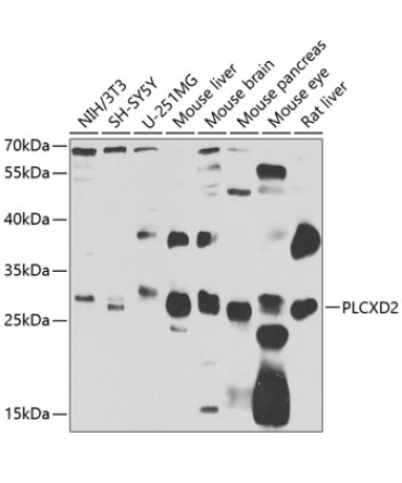 PLCXD2 Rabbit Polyclonal Antibody