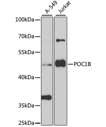 POC1B Rabbit Polyclonal Antibody