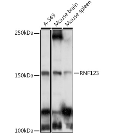 RNF123 Rabbit Polyclonal Antibody