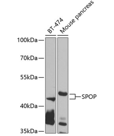 SPOP Rabbit Polyclonal Antibody