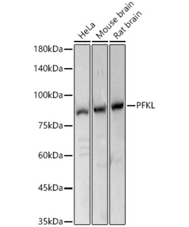 PFKL Rabbit Polyclonal Antibody
