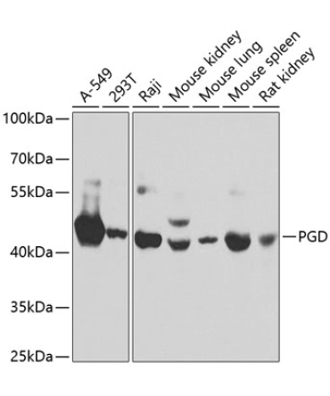 PGD Rabbit Polyclonal Antibody