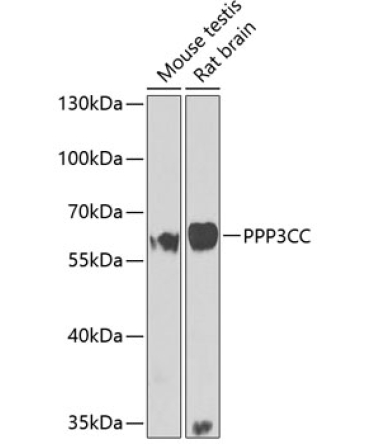 PPP3CC Rabbit Polyclonal Antibody