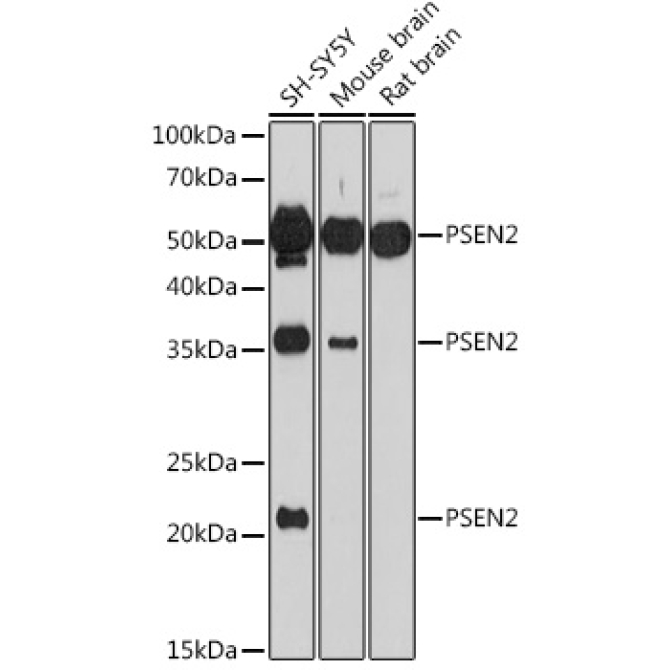 PSEN2 Rabbit Polyclonal Antibody