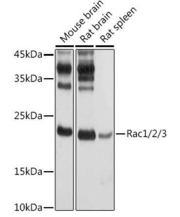 Rac1/2/3 Rabbit Polyclonal Antibody