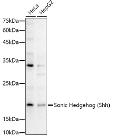 Sonic Hedgehog (Shh) Rabbit Polyclonal Antibody