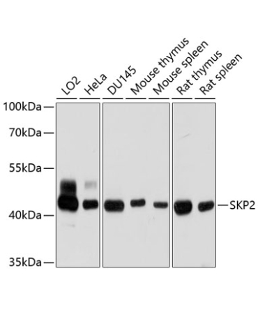 SKP2 Rabbit Polyclonal Antibody