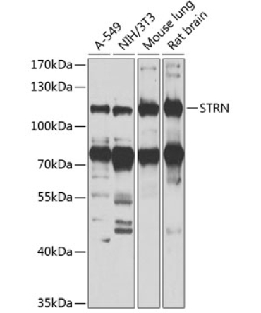 STRN Rabbit Polyclonal Antibody