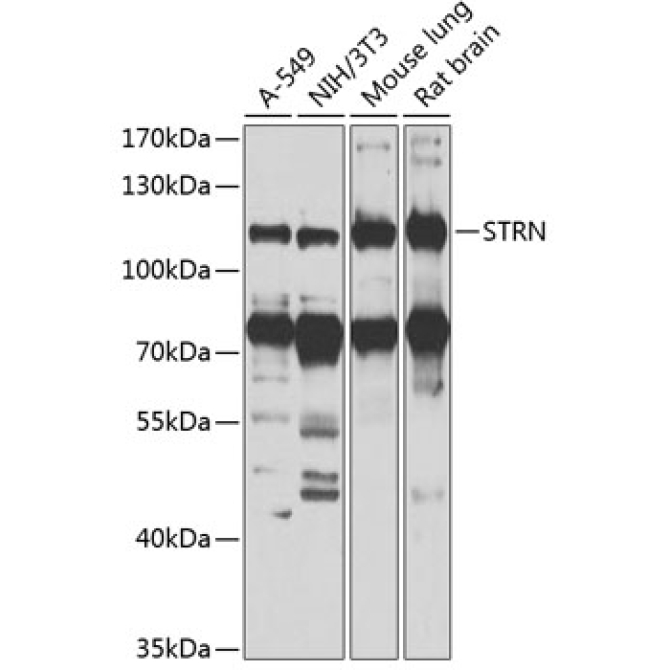 STRN Rabbit Polyclonal Antibody