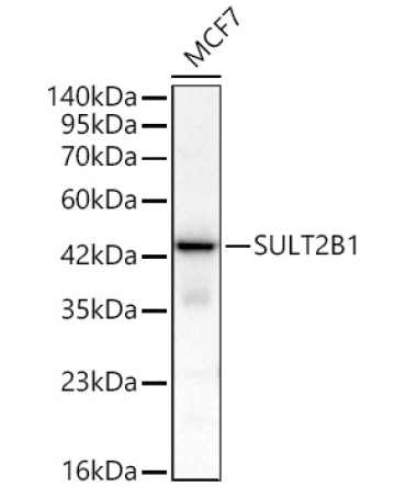 SULT2B1 Rabbit Polyclonal Antibody