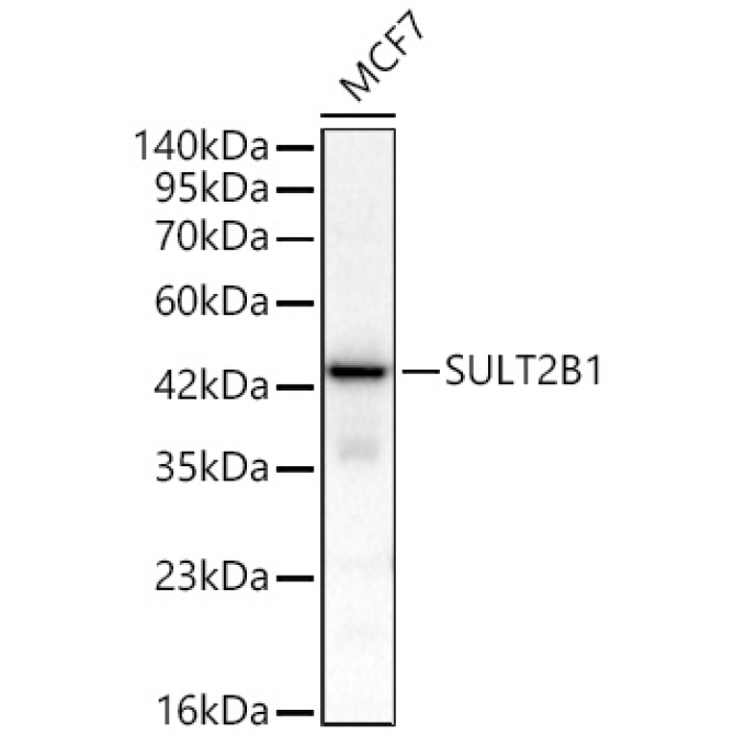SULT2B1 Rabbit Polyclonal Antibody