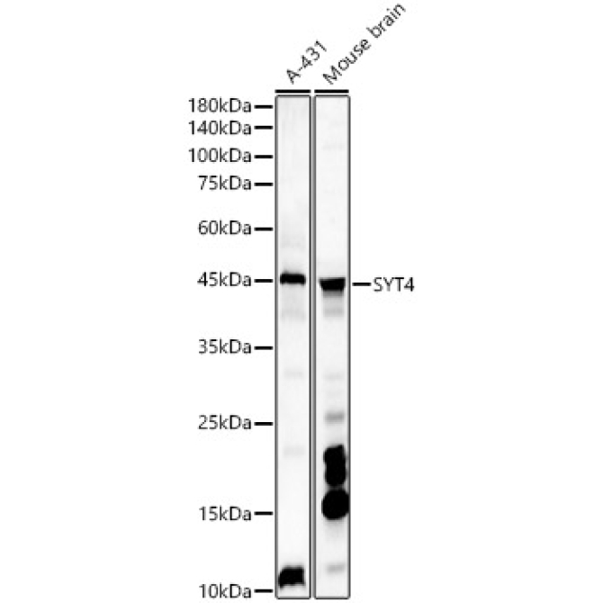 SYT4 Rabbit Polyclonal Antibody