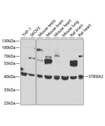 ST8SIA2 Rabbit Polyclonal Antibody