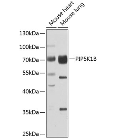 PIP5K1B Rabbit Polyclonal Antibody