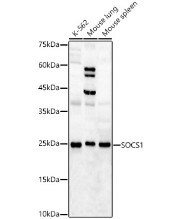SOCS1 Rabbit Polyclonal Antibody