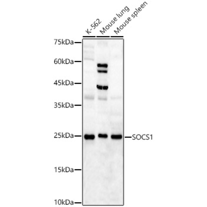 SOCS1 Rabbit Polyclonal Antibody